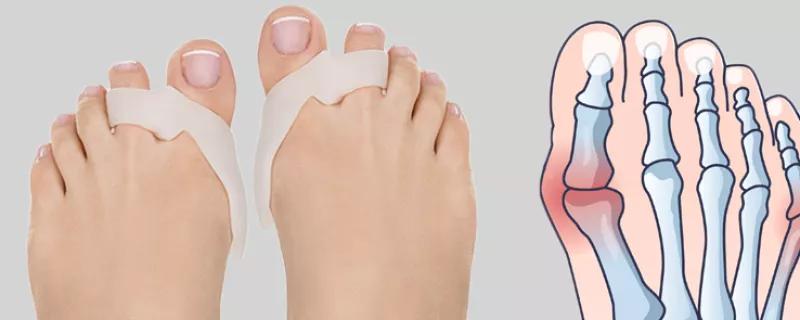 Enkelsidig eller dubbelsidigt stöd för hallux valgus